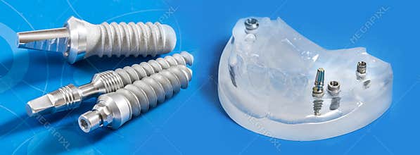 Dental implants