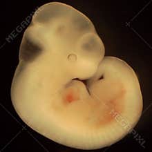 Mouse embryo, day 11 of development