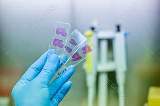 Hand in blue glove with histological rat liver, kidney an spleen tissue samples