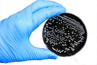 Bacterial Colonies