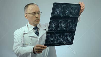 Experienced cardiologist checking CT scan of blood vessels, looking surprised