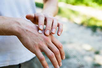 Applying an cream emollient to dry flaky skin as in the treatment of psoriasis, eczema and other dry skin conditions