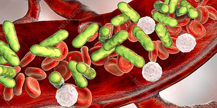 Sepsis, bacteria in blood