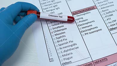 Chickenpox, doctor checking disease in lab blank, showing blood sample in tube