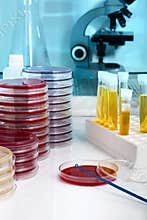 Working table of a microbiology laboratory with samples and test