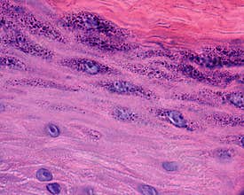 Human skin. Epidermis layers