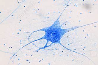 Motor Neuron under the microscope.