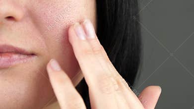 The girl examines the problem skin with enlarged pores, touching her face with her fingers. Part of a woman`s face