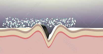 Anti-wrinkle skin treatment. 3d animation.