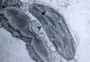 A ultrathin section of tobacco leaf mesophyll cells showing chloroplast structure