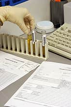 The urine analysis