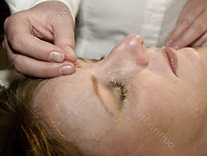 Acupuncture Concept