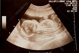 Sonogram