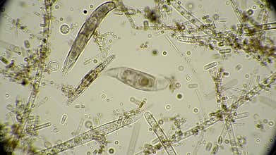Dynamic Microscopic View of Protozoa Amidst Plant Debris in Bright Field Illumination Studying Diverse Microorganisms and