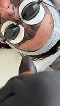 Young woman getting carbon laser facial at beauty clinic. Professional skincare