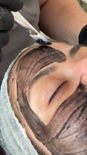Young woman getting carbon laser facial at beauty clinic. Professional skincare