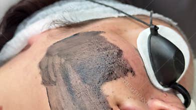 Young woman getting carbon laser facial at beauty clinic. Professional skincare