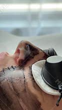 Young woman getting carbon laser facial at beauty clinic. Professional skincare