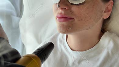 Young woman getting carbon laser facial at beauty clinic. Professional skincare