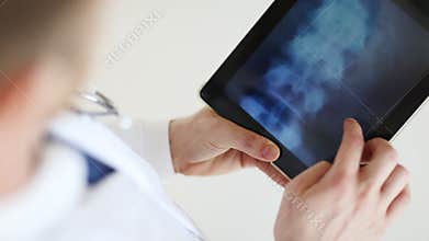Doctor working with x-ray scan on tablet pc