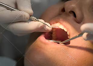 Dental visist