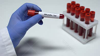 ANA profile, doctor showing blood sample in tube, lab research, health checkup