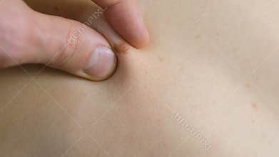 Man`s hand touches the mole on the woman`s skin. Doctor medical screening. Close up hand and mole.