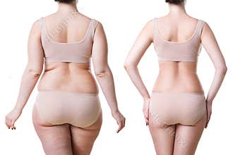 Woman`s body before and after weight loss isolated on white background