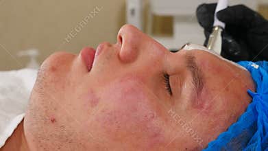 Skin care, dermatology treatment in beauty salon. Beautician applying white moisturizing mask on male face skin. Spa