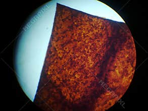 Osteocyte; osteocytes; bone cell
