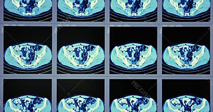 Many computed tomography scans in motion of lower and middle abdominal area