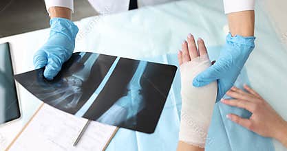 Doctor holds x-ray of hand and examines patient sore arm