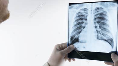 X-ray of human lungs isolated on white background close-up