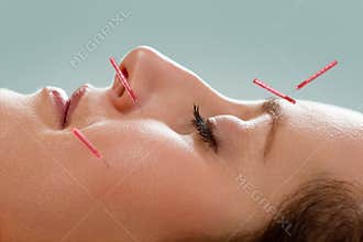 Facial acupuncture
