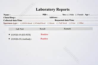 COVID-19 positive test results