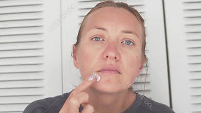 A woman with a herpes rash on her face applies a medicated ointment to inflamed skin