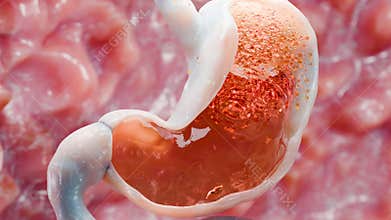 Stomach Acid Relux. Esophagus, gerd. Pain In The Digestive System, Gastritis, pyrosis, human body organ Anatomy