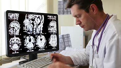 Doctor looking at CT scan