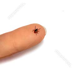 Tick human finger