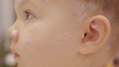 Child gets ointment for chickenpox sores on face and head in home setting
