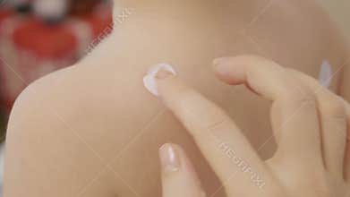 Applying ointment to blisters on a boy with chickenpox at home
