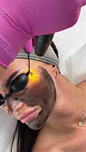 Young woman getting carbon laser facial at beauty clinic. Professional skincare