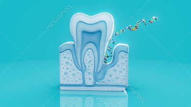 3D animation of periodontitis with bacteria under the gums
