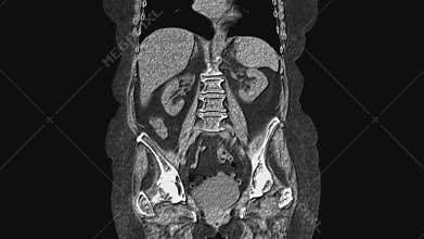 Voluminous MRI of the abdominal cavity, gastrointestinal tract, bladder