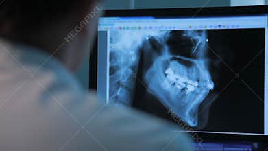 Temporomandibular joint dysfunction.TMJD or TMD.