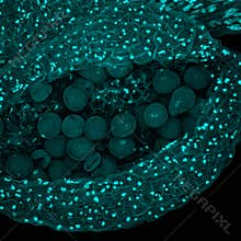 Pollens in anther
