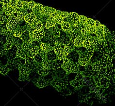 Chloroplasts