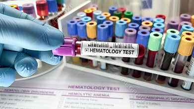 Doctor holding Blood sample tube for analysis in Hematology laboratory