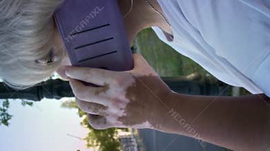 Old woman with pigmentation on skin talks by phone on street