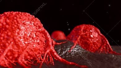 A 3D cancer cells with a characteristic of malignancy.